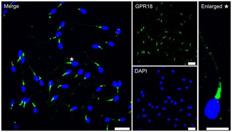 Nature子刊：首次鉴定出激活人精子的大麻素受体GPR18
